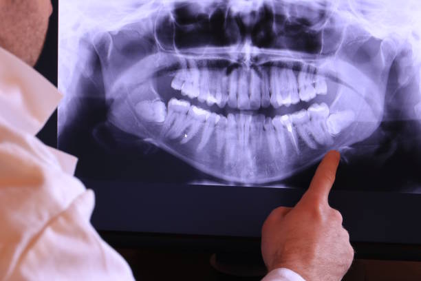 Best Cracked Tooth Emergency Dentist  in Mulberry, OH
