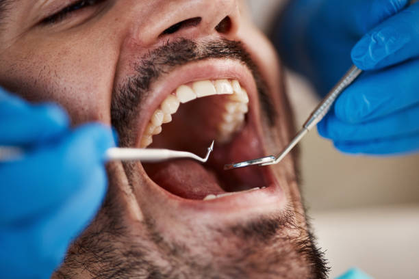 Best Teeth Whitening  in Mulberry, OH
